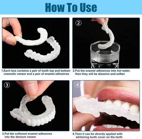 Adjustable Snap-On Dentures