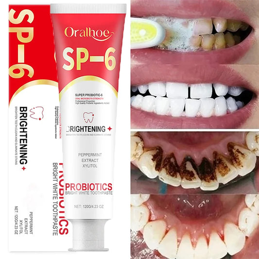 1 A Dental Whiten Probiotic Toothpaste