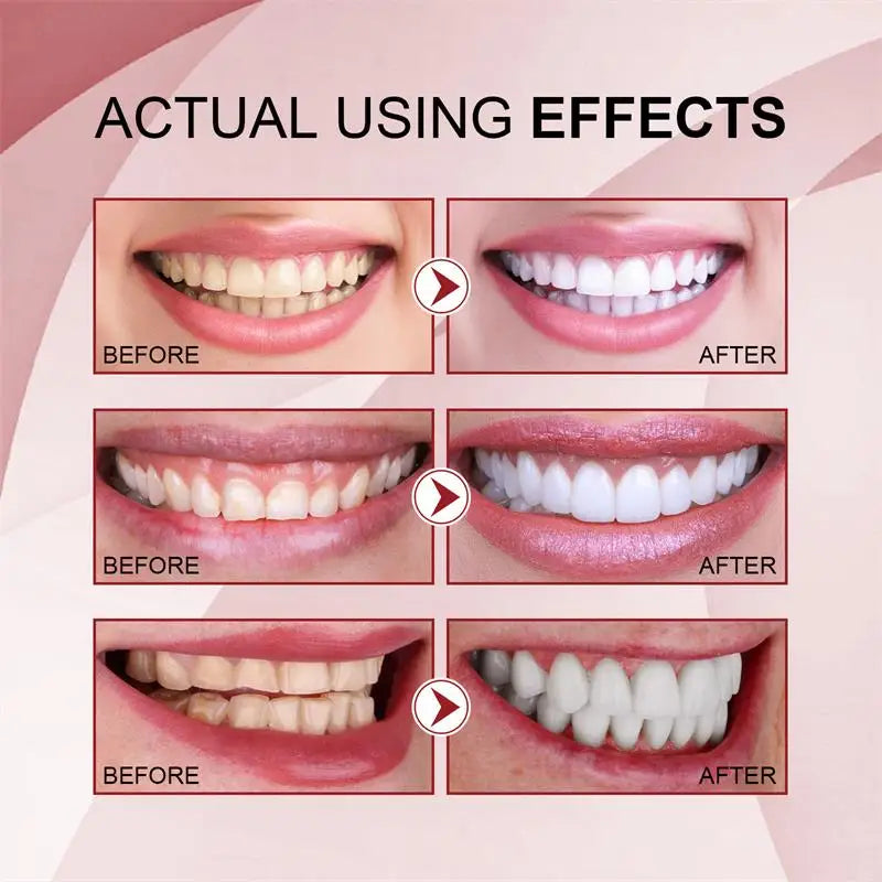 1 A Dental Whiten Probiotic Toothpaste